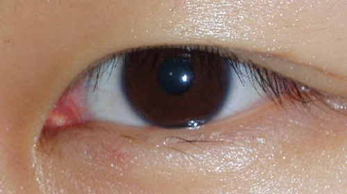 눈으로 보는 건강신호 12가지…당신의 눈 상태는?