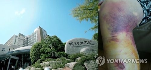 대리수술 23회, 전공의 원산폭격·방망이 폭행…부산대병원 민낯