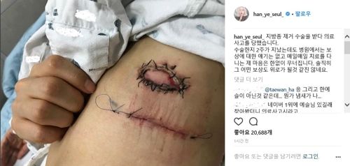 '한예슬 의료사고' 차병원 "회복 지원…보상 논의 중"