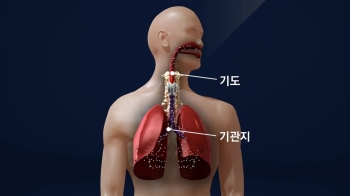 폐 통해 혈관 스며드는 '미세먼지'…우리 몸에 어떤 영향?