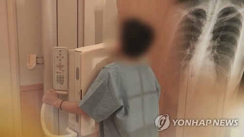 '사망1위' 폐암 국가암검진 7월 시행…본인부담 약 1만1천원