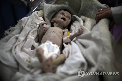 뼈만 앙상한 아기…충격적 사진에 시리아 인도주의 경종
