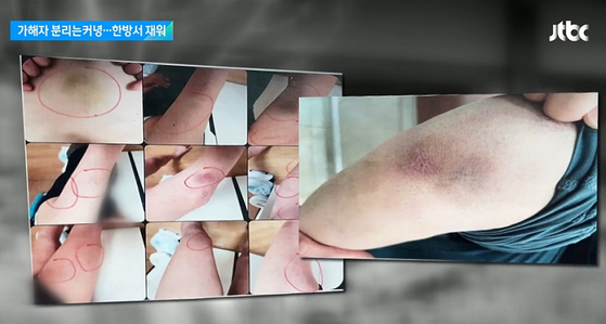 초등학생 B양이 서당 기숙사에서 폭행 당한 모습. 〈사진-JTBC 캡쳐〉