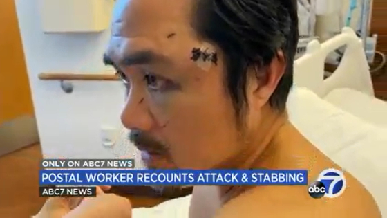 지난달 퇴근길에 다섯 번 칼부림을 당한 뒤 크게 다친 아시아계 남성이 상처를 들어 보이고 있다. 〈사진=ABC방송 캡처〉