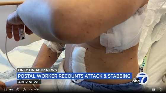 지난달 퇴근길에 다섯 번 칼부림을 당한 뒤 크게 다친 아시아계 남성이 상처를 들어 보이고 있다. 〈사진=ABC방송 캡처〉