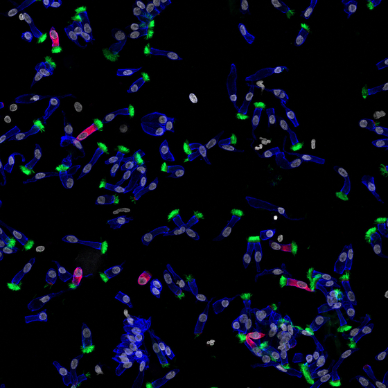 섬모세포들(연두색)에서만 코로나 바이러스(선홍색) 복제·증식 포착. 출처=IBS