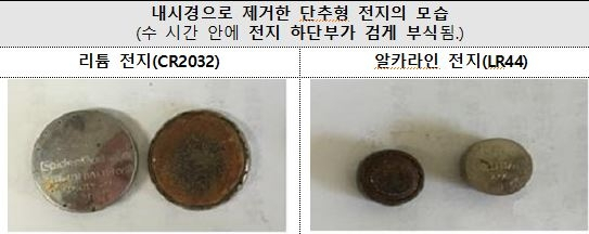 내시경으로 제거한 단추형 전지 모습. 〈사진=한국소비자원〉