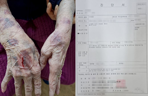 경북 김천의 한 노인보호센터에서 자신의 할머니를 학대했다는 글이 올라와 누리꾼들의 공분을 사고 있다. 〈사진=온라인 커뮤니티 캡처〉